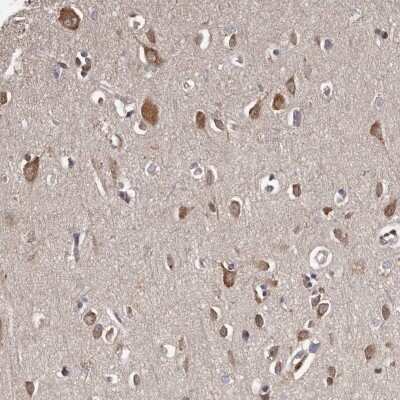 Immunohistochemistry-Paraffin: TNRC4 Antibody [NBP1-89933]