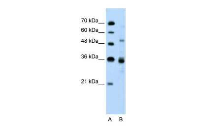 Western Blot: TNRC4 Antibody [NBP2-83704]