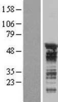 Western Blot: TNRC4 Overexpression Lysate [NBL1-17183]