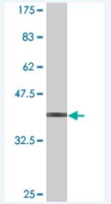 Western Blot: TNRC6B Antibody (4B11) [H00023112-M02]