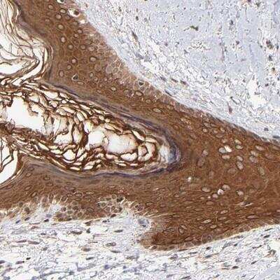 Immunohistochemistry-Paraffin: TNRC6B Antibody [NBP1-81442]