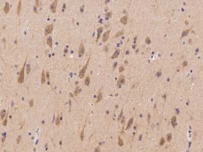 Immunohistochemistry-Paraffin: TNRC6B Antibody [NBP2-98079]