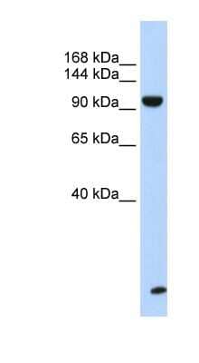 Western Blot: TNRC6B Antibody [NBP1-57461]