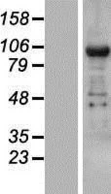 Western Blot: TNRC6B Overexpression Lysate [NBP2-08641]