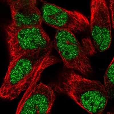 Immunocytochemistry/ Immunofluorescence: TNRC6C Antibody [NBP2-56257]