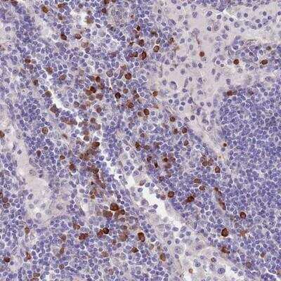 Immunohistochemistry-Paraffin: TNRC6C Antibody [NBP2-13462]