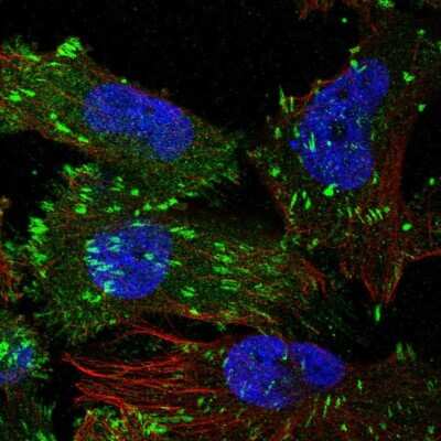 Immunocytochemistry/ Immunofluorescence: TNS3 Antibody [NBP2-37948]