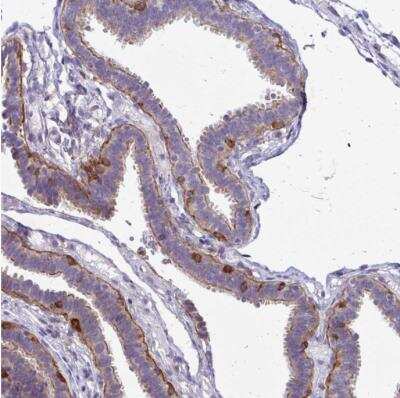 Immunohistochemistry-Paraffin: TNS3 Antibody [NBP2-37948]