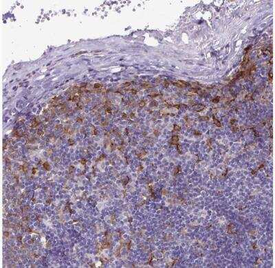 Immunohistochemistry-Paraffin: TNS3 Antibody [NBP2-37948]