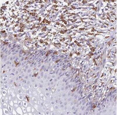 Immunohistochemistry-Paraffin: TNS3 Antibody [NBP2-37948]