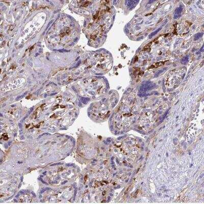 Immunohistochemistry-Paraffin: TNS3 Antibody [NBP2-37948]