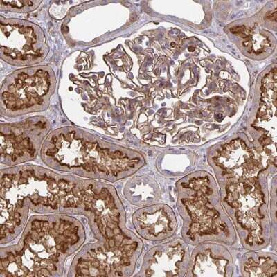Immunohistochemistry-Paraffin: TNS3 Antibody [NBP2-37952]