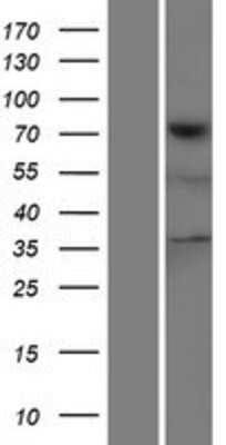 Western Blot: Tensin 4/CTEN Overexpression Lysate [NBP2-05961]