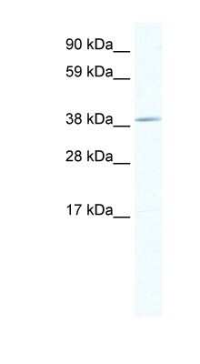 Western Blot: TOB1 Antibody [NBP1-80225]