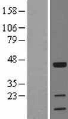 Western Blot: TOB1 Overexpression Lysate [NBL1-17185]