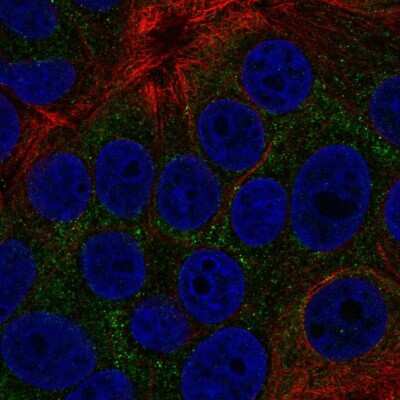 Immunocytochemistry/ Immunofluorescence: TOB2 Antibody [NBP2-55030]