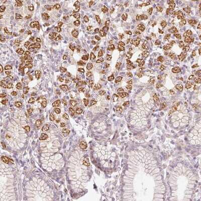 Immunohistochemistry-Paraffin: TOB2 Antibody [NBP2-49117]