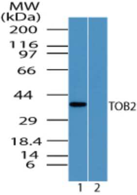 Western Blot: TOB2 Antibody [NBP2-24619]