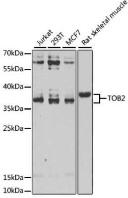 Western Blot: TOB2 AntibodyBSA Free [NBP2-93026]