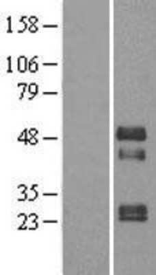 Western Blot: TOB2 Overexpression Lysate [NBP2-04353]