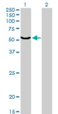 Western Blot: TOE1 Antibody (1D8) [H00114034-M01]