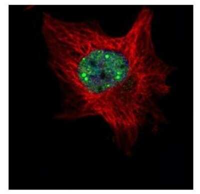 Immunocytochemistry/ Immunofluorescence: TOE1 Antibody [NBP2-20678]