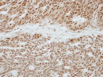 Immunohistochemistry-Paraffin: TOE1 Antibody [NBP2-20678]