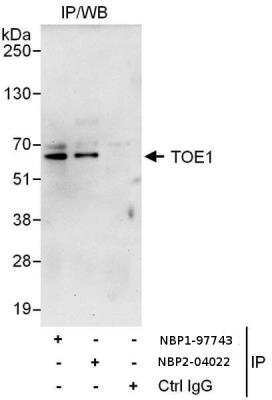 Immunoprecipitation: TOE1 Antibody [NBP2-04022]