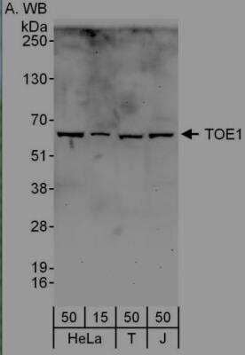 Immunoprecipitation: TOE1 Antibody [NBP2-04022]