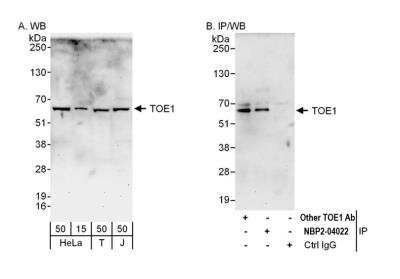 Immunoprecipitation: TOE1 Antibody [NBP2-04022]