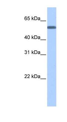 Western Blot: TOE1 Antibody [NBP1-53158]