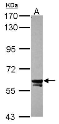 Western Blot: TOE1 Antibody [NBP2-20678]