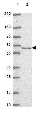 Western Blot: TOE1 Antibody [NBP2-49587]