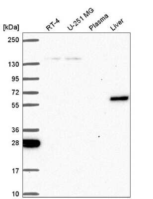 Western Blot: TOE1 Antibody [NBP2-56752]