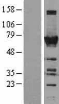 Western Blot: TOE1 Overexpression Lysate [NBL1-17187]