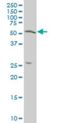 Western Blot: TOM1 Antibody (1C5) [H00010043-M06]