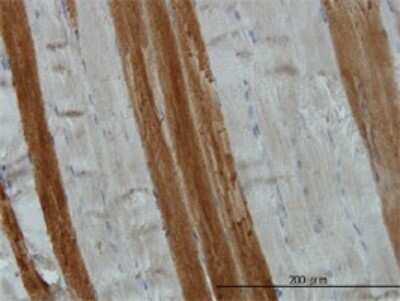 Immunohistochemistry-Paraffin: TOM1 Antibody (5A3) [H00010043-M01]