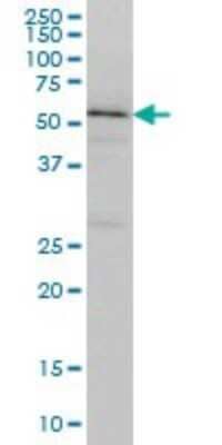 Western Blot: TOM1 Antibody (5A3) [H00010043-M01]