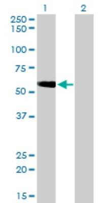 Western Blot: TOM1 Antibody (5A3) [H00010043-M01]