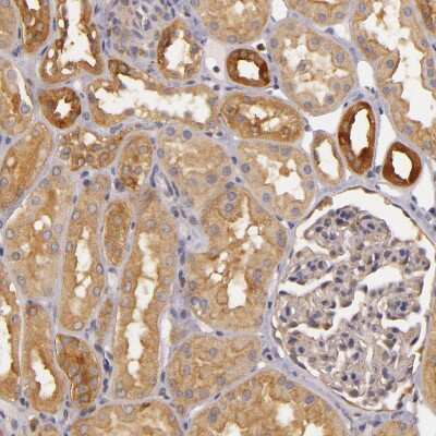 Immunohistochemistry-Paraffin: TOM1 Antibody [NBP1-86170]