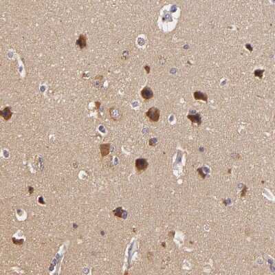 Immunohistochemistry-Paraffin: TOM1 Antibody [NBP1-86170]