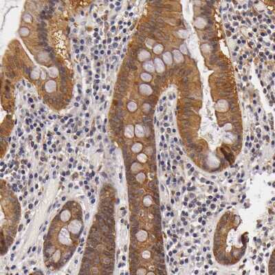 Immunohistochemistry-Paraffin: TOM1 Antibody [NBP1-86170]