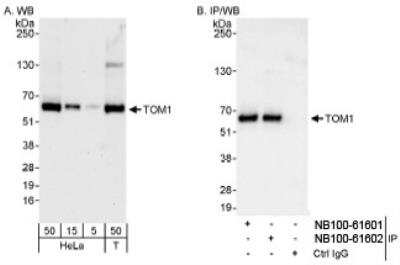 Western Blot: TOM1 Antibody [NB100-61602]