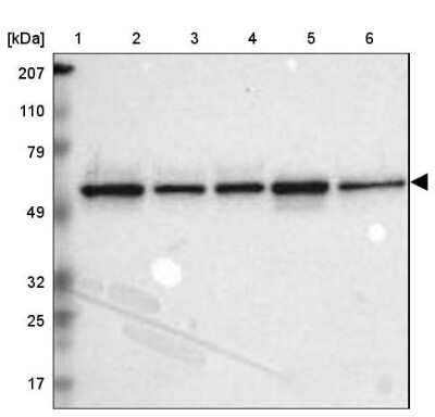 Western Blot: TOM1 Antibody [NBP1-86170]