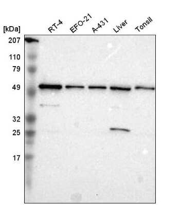 Western Blot: TOM1 Antibody [NBP2-55152]