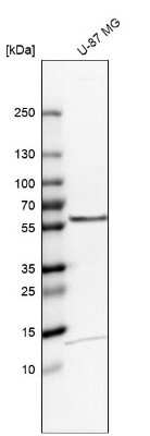 Western Blot: TOM1 Antibody [NBP2-55152]