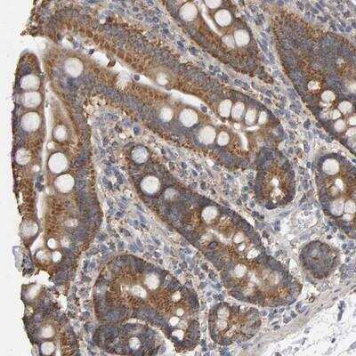 Immunohistochemistry: TOM1L1 Antibody [NBP1-87004]