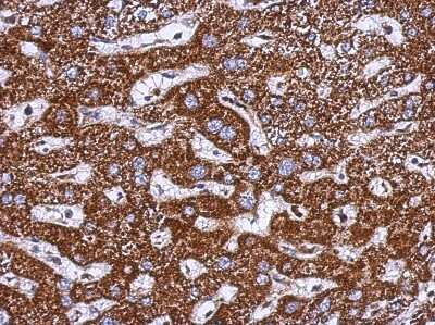 Immunohistochemistry-Paraffin: TOM1L1 Antibody [NBP2-20681]