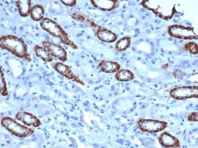 Immunohistochemistry-Paraffin: TOM1L1 Antibody (TOM1L1/4690) - Azide and BSA Free [NBP3-08878]