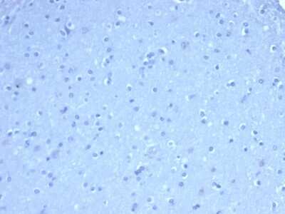 Immunohistochemistry-Paraffin: TOM1L1 Antibody (TOM1L1/4690) - Azide and BSA Free [NBP3-08878]